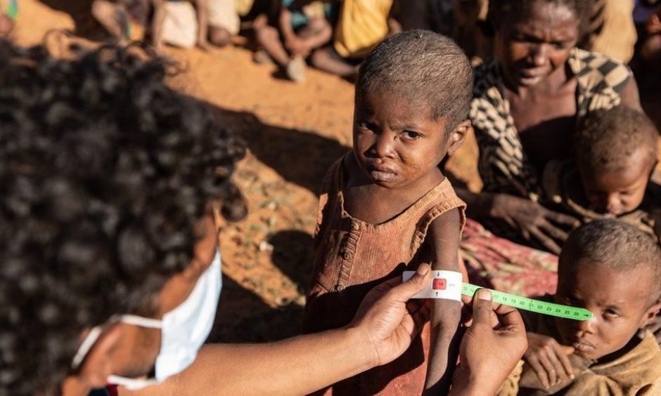 At least half a million children under the age of five are in danger of being acutely malnourished, the UN says. Credit: Tsiory Andriantsoarana, WFP